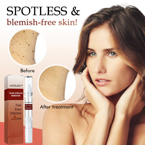 LOVILDS™ Correcteur Naturel aux Herbes pour Grains de Beauté et Verrues