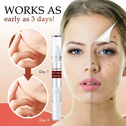 LOVILDS™ Correcteur Naturel aux Herbes pour Grains de Beauté et Verrues
