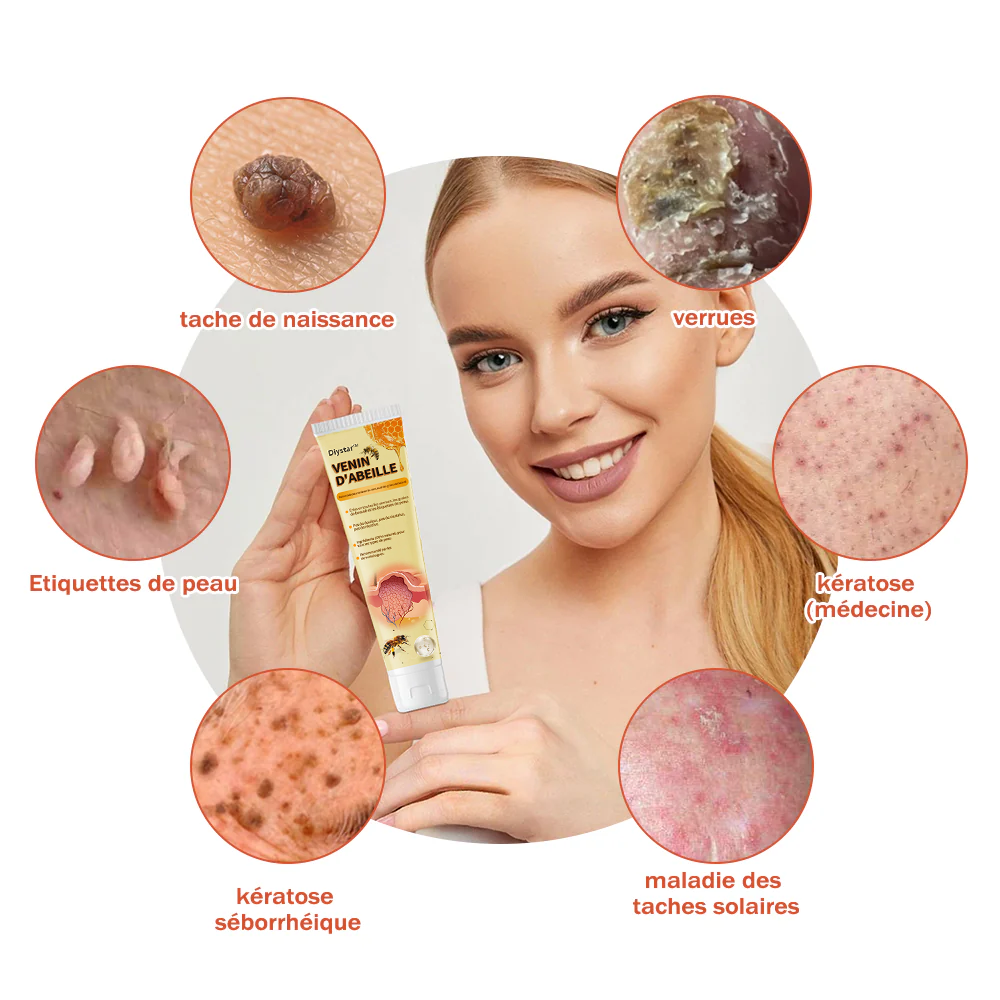 Diystar™ Crème Soin Expert pour Verrues et Grains de Beauté au Venin d’Abeille (Recommandée par la SFD 👩⚕)