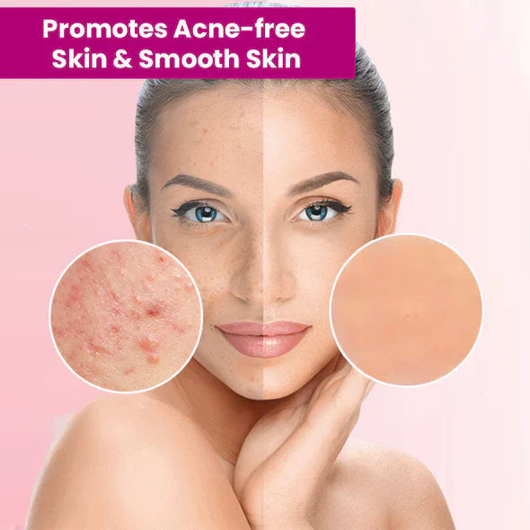 LOVILDS™ Correcteur Naturel aux Herbes pour Grains de Beauté et Verrues