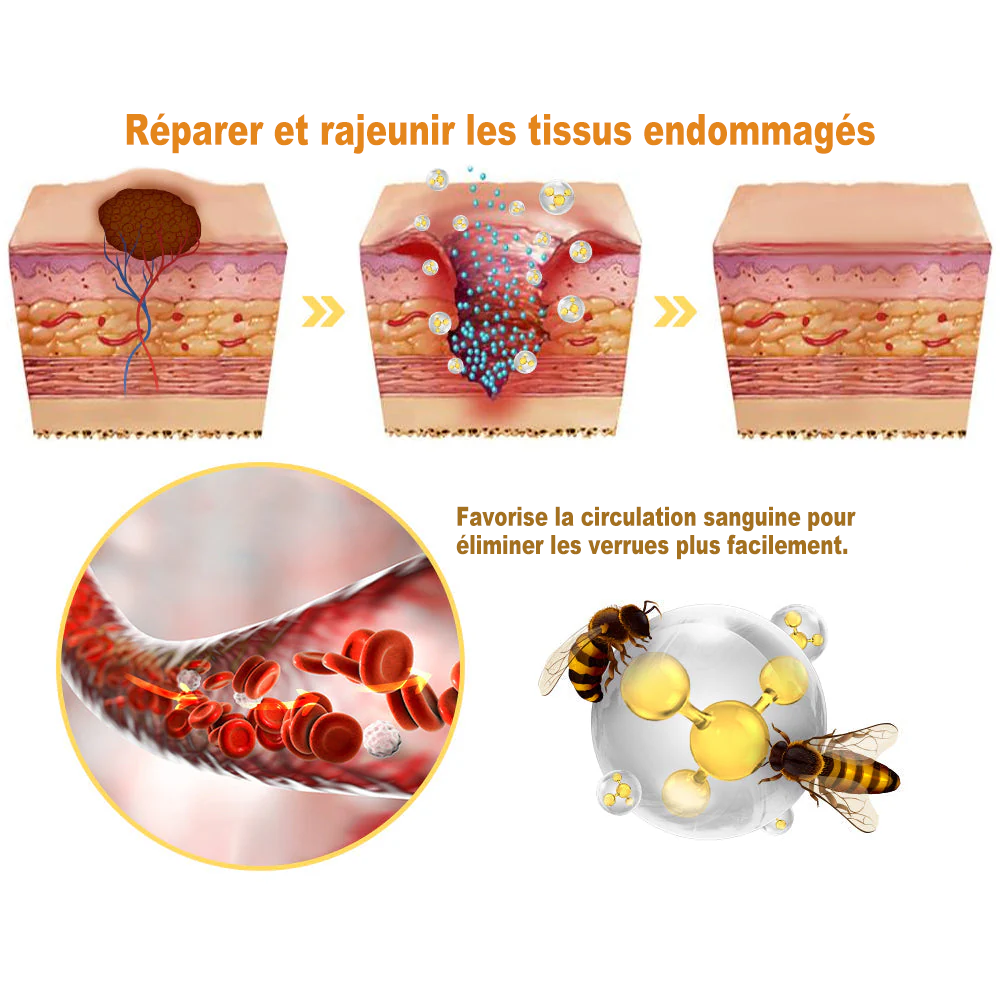 Diystar™ Crème Soin Expert pour Verrues et Grains de Beauté au Venin d’Abeille (Recommandée par la SFD 👩⚕)