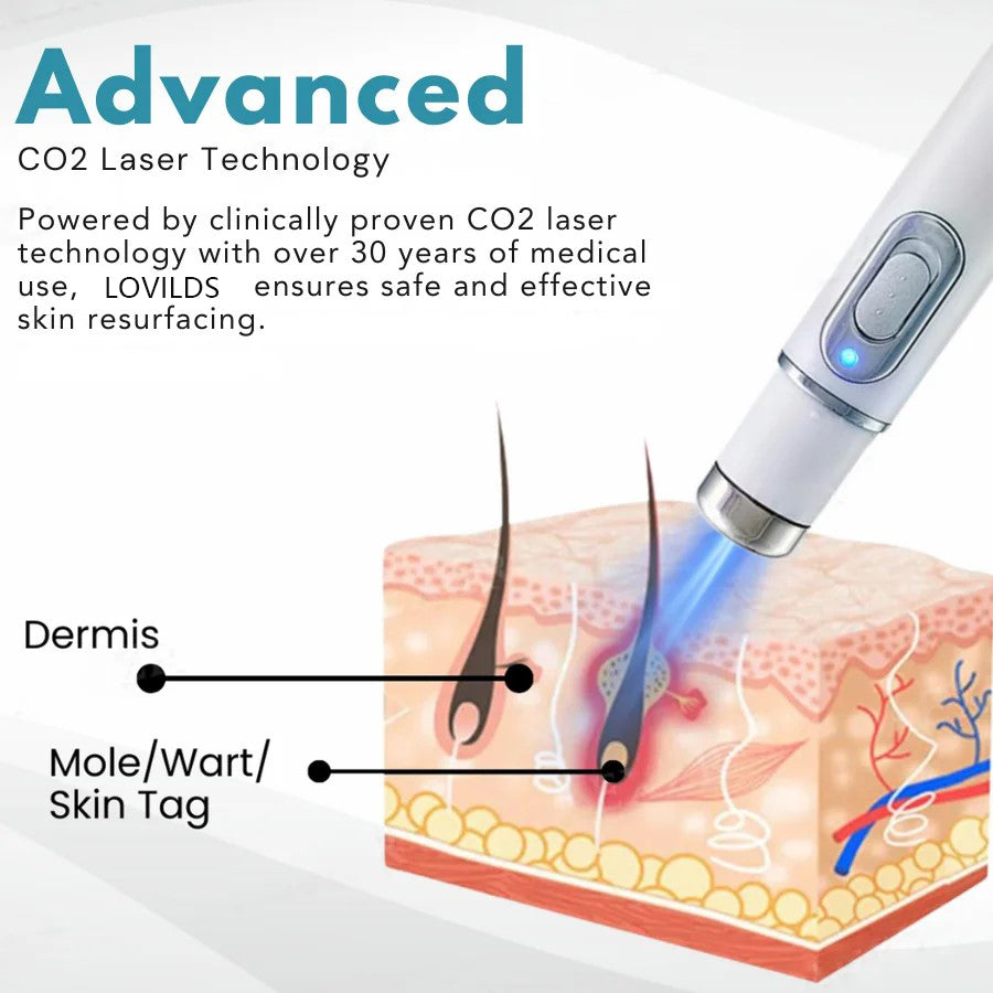 LOVILDS™ Stylo Laser Non Invasif pour l’Élimination des Grains de Beauté et des Verrues